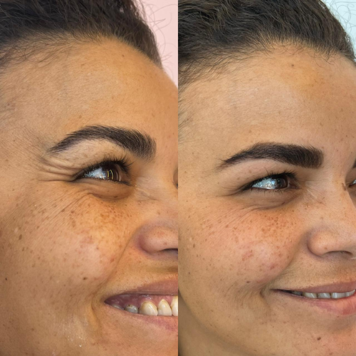 103